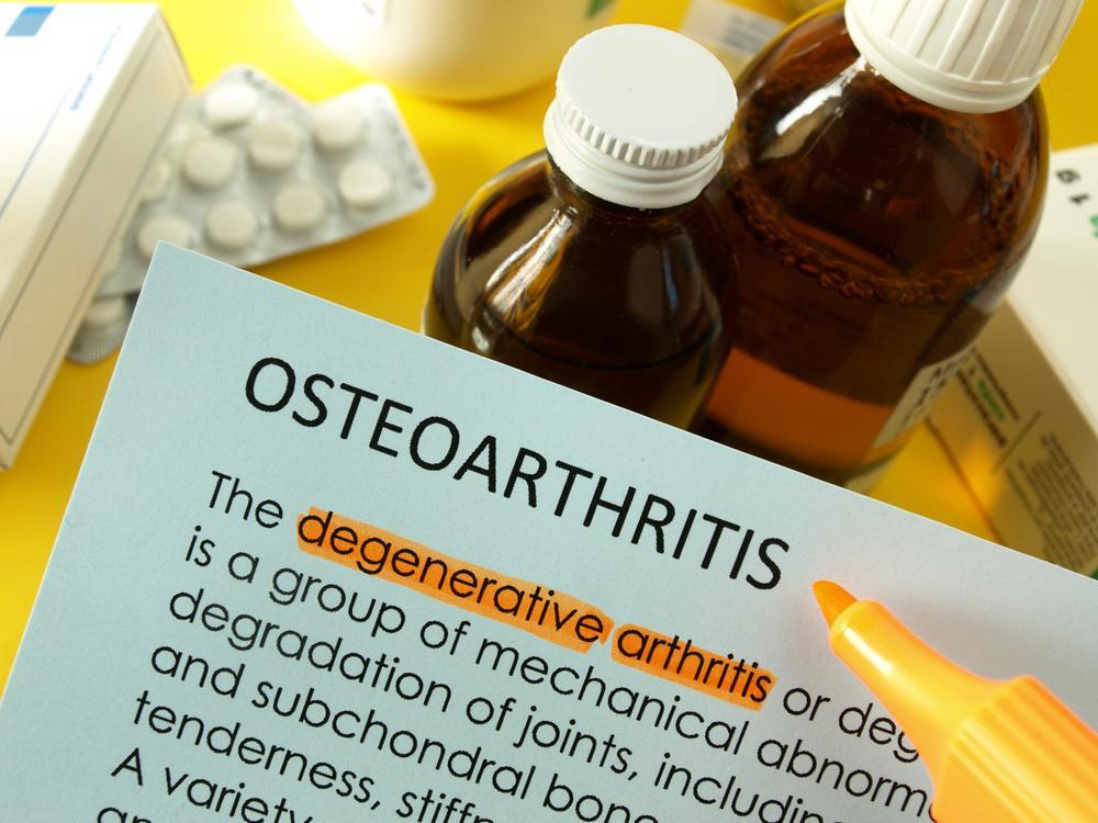 Osteoarthritis: Symptoms and Foods to Avoid