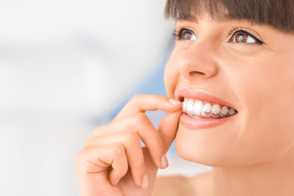 Top Invisible Aligners and Braces for Straightening Teeth